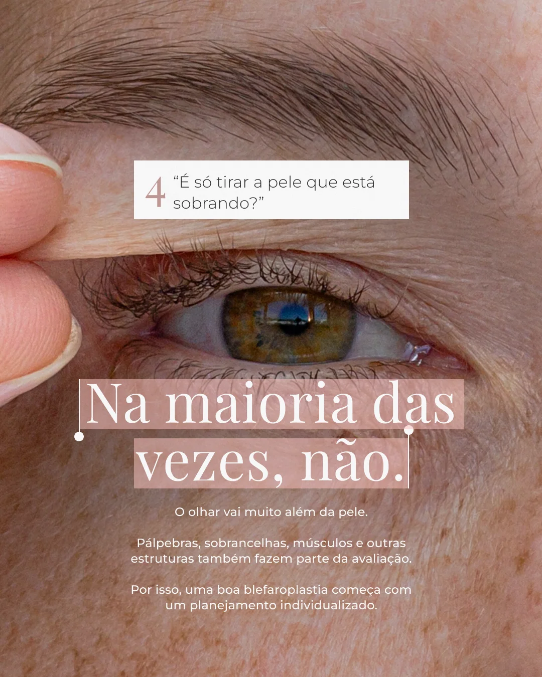 Blefaroplastia: dúvidas frequentes — lâmina 5 de 8